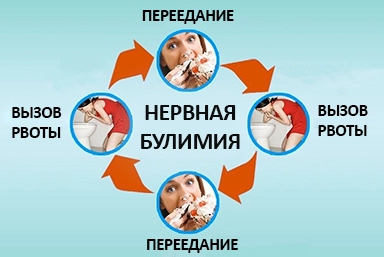 Лечение булимии в Стройкерамике